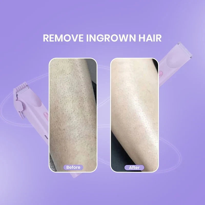 SmoothSilk™ 2-in-1 Hair Remover & Shaver – For Face, Body & Bikini Zone